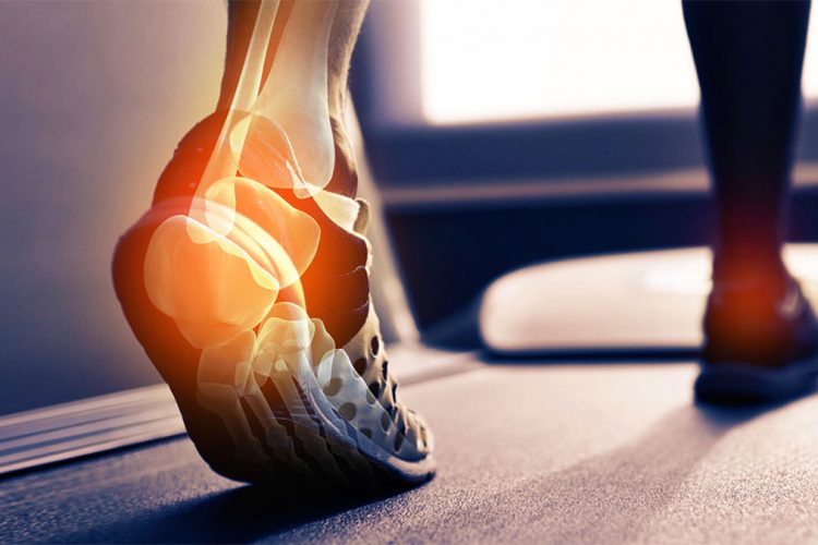 Dhimbja e kockave, si ndikon një orë ecje në javë për osteoartritin