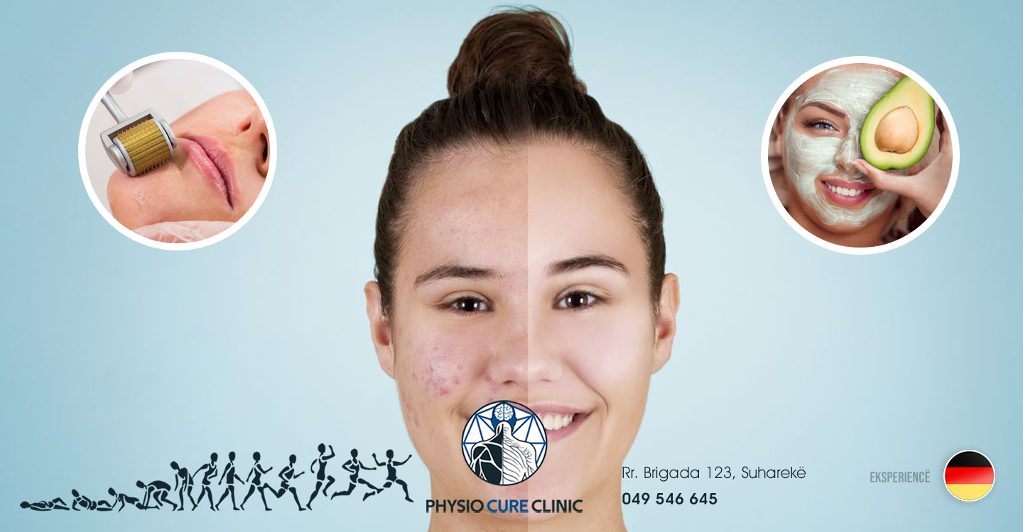 Nga tani në Physio Cure Clinic edhe trajtim i rrudhave, pikave të zeza dhe gjithçka për fytyrën tuaj