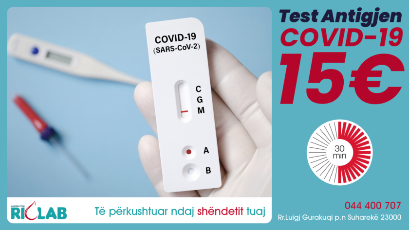 Test antigjen për COVID-19 vetëm 15€, rezultati brenda 30 minutave